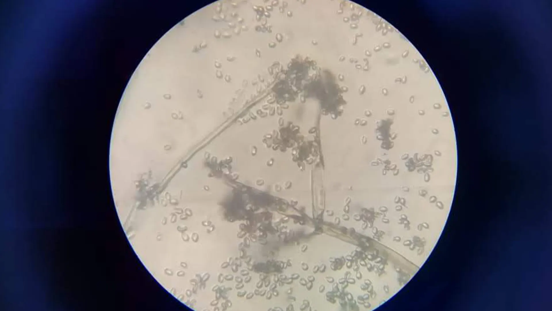 Botrytis spp. seen on microscope